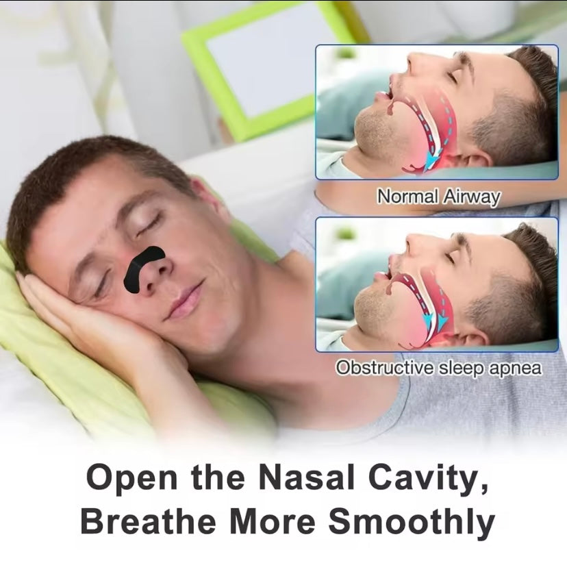 Harmony Essentials Nose Strips